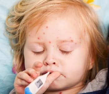 Les maladies infantiles